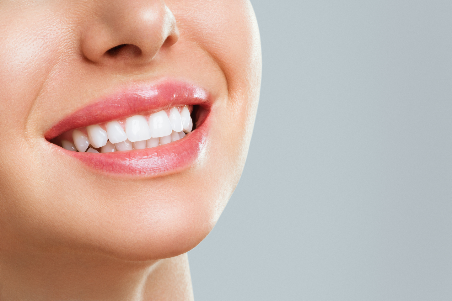 Is Professional Teeth Whitening Better | London SE1
