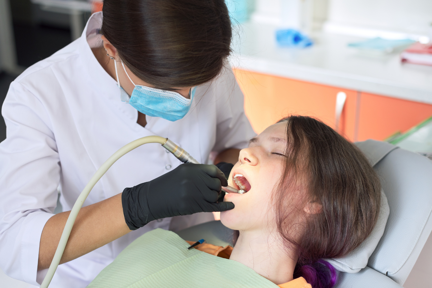 Can Composite Bonding Fix Chipped Teeth | Bonding in London